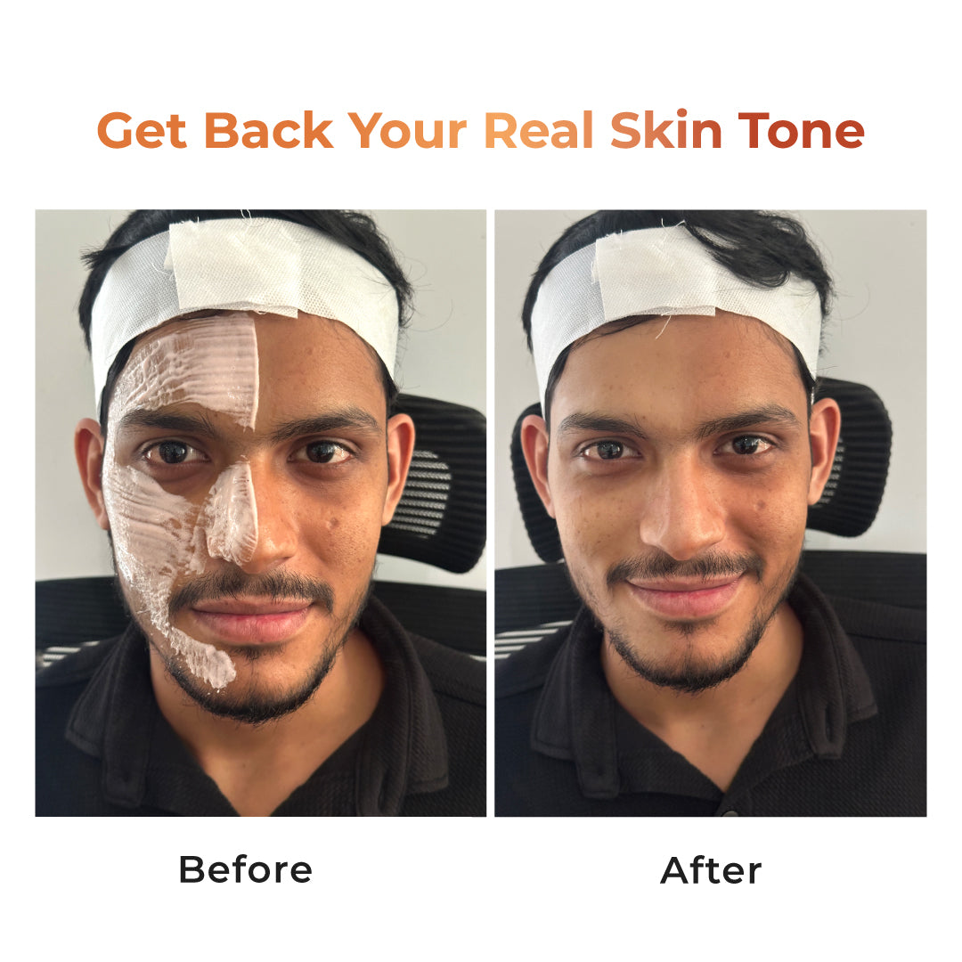 NICONI Tan Vanish Gluta-Kojic Skin Polish