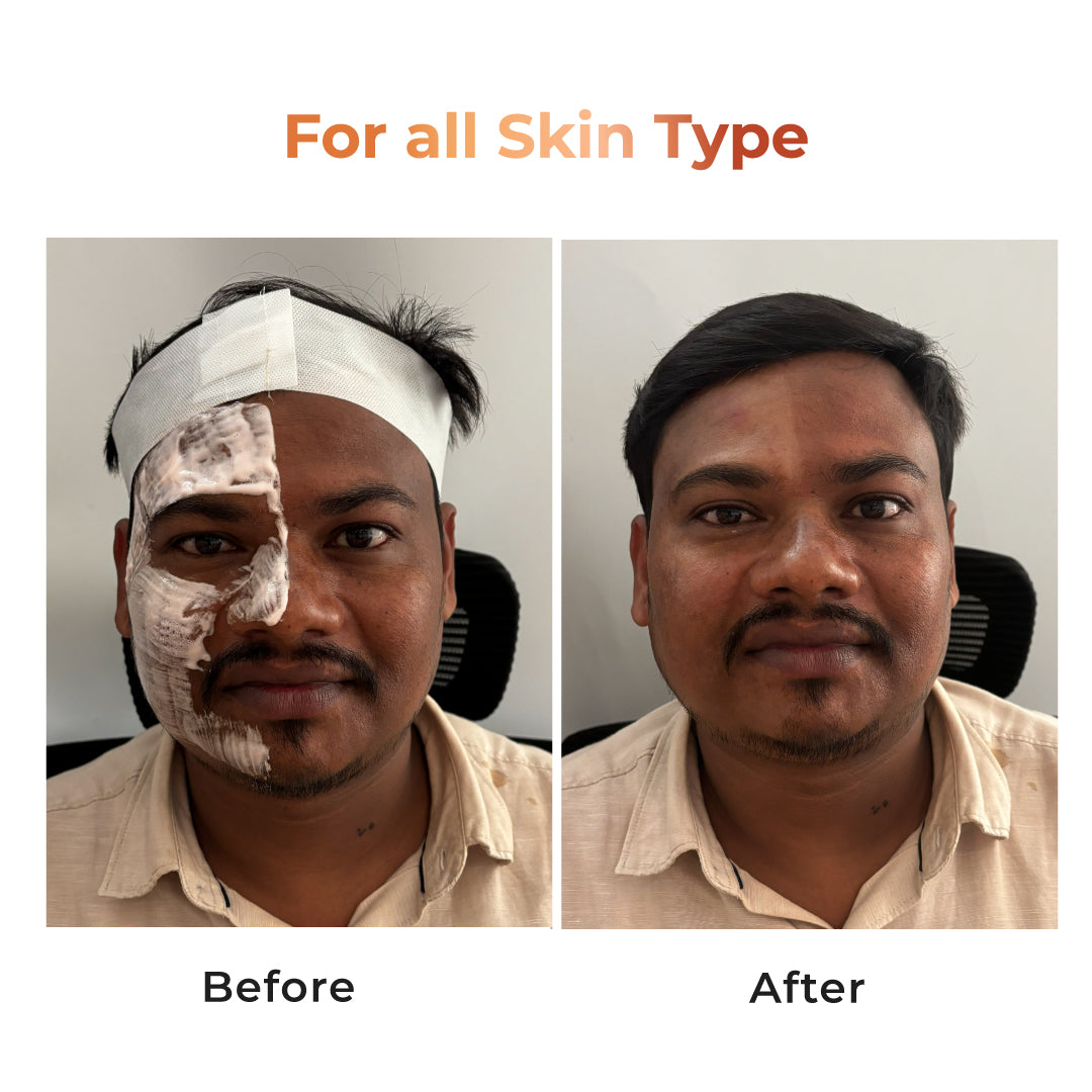 NICONI Tan Vanish Gluta-Kojic Skin Polish