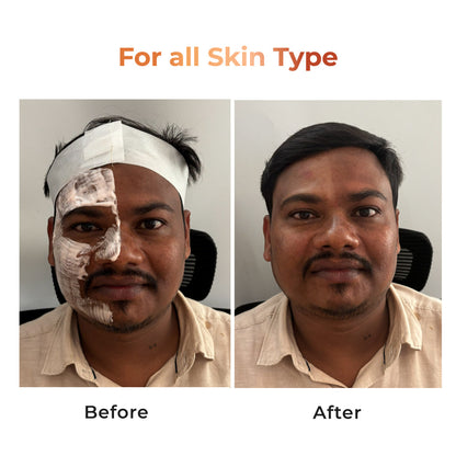NICONI Tan Vanish Gluta-Kojic Skin Polish