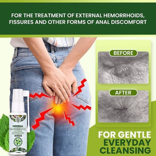 30ml Natural Herbal Hemorrhoid Care Spray – External Itching & Swelling Relief