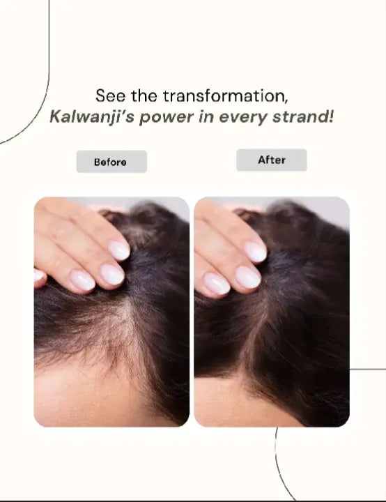 Kalwanji Hair Shampoo CH6 400ml Brightening Anti-Dandruff